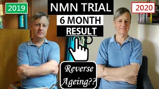 NMN Resveratrol Trial Six Months' Result | Reverse Aging??