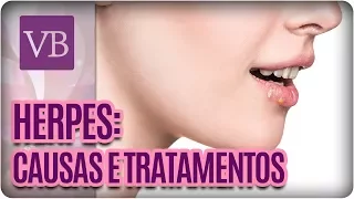 O que são herpes? Entenda as Causas e Tratamentos - Você Bonita (11/07/17)