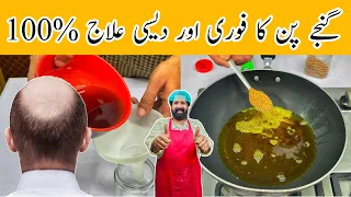 Homemade Hair Oil For 4x Faster Hair Growth And Dandruff | Hair Growth Oli Remedy By BaBa Food RRC