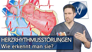 Herzrhythmusstörungen: Von Vorhofflimmern bis unregelmäßige Herzschläge - Symptome, Folgen, Therapie