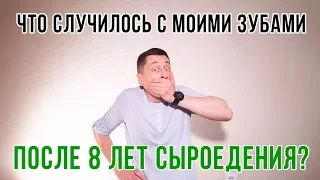 ЧТО СЛУЧИЛОСЬ С МОИМИ ЗУБАМИ СПУСТЯ 8 ЛЕТ СЫРОЕДЕНИЯ? 😬