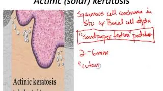 USMLE Review - Dermatology (Skin Pathology)