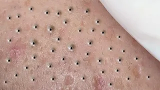 Satisfying Relaxing with Sac Dep Spa Video (#183)