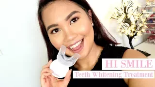 HiSmile Teeth Whitening Treatment / BEFORE & AFTER RESULT