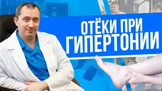 Отёки при гипертонии