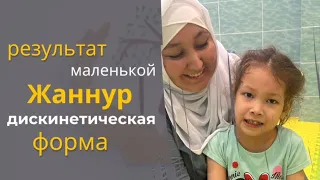 Результаты маленькой Жаннур - дискинетическая форма