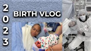 C Section birth vlog 2023