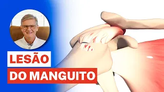 DOR NO OMBRO? Pode ser Lesão de Manguito Rotador (Sintomas, Diagnóstico e Tratamento)