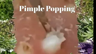 Popping Pimples and Blackheads - 3