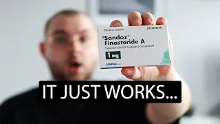 1 Year On Finasteride Here's What Happened To My Hair| Finasteride Results After 1 Year