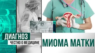 Миома матки: современные методы лечения | Диагноз