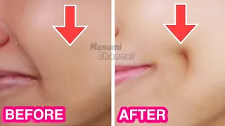 How To Get Dimples Fast & Naturally! Simple Facial Exercises to get Dimples without Surgery