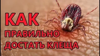 Как ПРАВИЛЬНО достать/вынуть клеща и все ли клещи опасны? How CORRECT to get a tick?