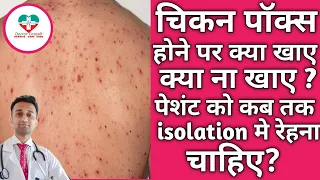 Chicken Pox Diet And Isolation! चिकन पॉक्स होने पर क्या खाए?