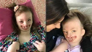 Disabled girl who was bullied by vile trolls has died aged 10