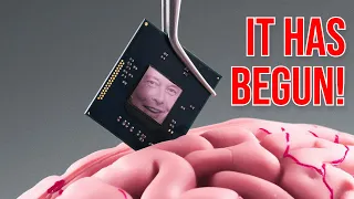 Elon Musk's Neuralink Brain Chips HUMAN TRIALS: Would You Take the Risk?