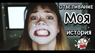 ОТБЕЛИВАНИЕ ЗУБОВ | МОЯ ИСТОРИЯ | ПЛЮСЫ И МИНУСЫ ОТБЕЛИВАНИЯ