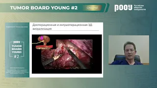 Tumor Board Young #2: «Хирургическое лечение»