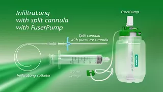 alrihan and pajunk peripheral infiltration