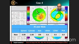 Corena - To The Wonderland -  Keratoconus Decision Making - Mazen Sinjab