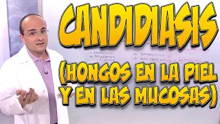 Candidiasis Hongos en la piel y en las mucosas