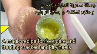 Treating cracked and dry feet with a successful natural recipe with quick results