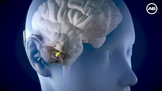 How a Cochlear Implant Works with HiRes Ultra by Advanced Bionics 1080p
