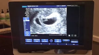 Listening the baby's heart beat for the first time