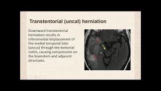 introduction to neuroimaging
