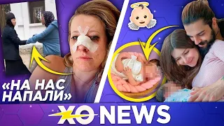 ЖЕСТОКОЕ НАПАДЕНИЕ НА СОБЧАК / ФОТОСЕССИЯ СКАЙЛЕР / XO NEWS