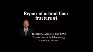 Repair of orbital floor fracture 1