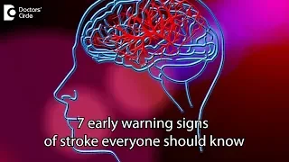 Early warning signs & symptoms of Stroke - Dr.Anil R