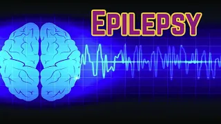 Epilepsy (updated 2023) - CRASH! Medical Review Series