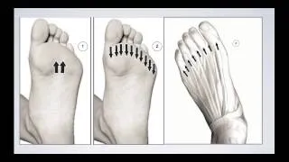 Bowen for Bunions Plantar Ankle