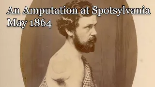 A Civil War officer's grisly amputation at the Battle of Spotsylvania Court House - May 1864