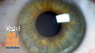 Could bionic eyes help us see better? | All Science. No Fiction.