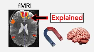 fMRI (Functional Magnetic Resonance Imaging) Explained