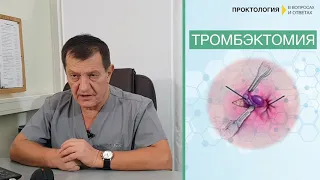 ПОСЛЕДСТВИЯ тромбэктомии ПОСЛЕ УДАЛЕНИЯ геморроидального узла геморроя