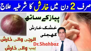 Kharish Ka ilaj | Kharish Khatam Karne Ka Tarika | خارش کا علاج | Harish Ka ilaj | Dr Shahbaz