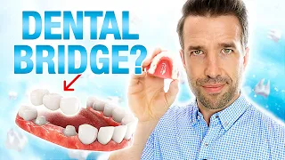 You Need to Know This About a Dental Bridge