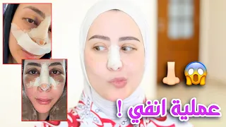 سويت عمليه لأنفي 😳 شوفوا شكلي كيف صار !! " التجربه كامله + نصائح "👃🏻💕