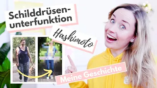 Schilddrüsenunterfunktion & Hashimoto: Meine Erfahrungen - wie geht es mir jetzt?