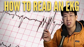 How To Read An EKG In 2023 (High Yield)