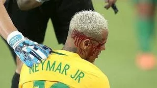 Neymar Eye Injury vs Bolivia