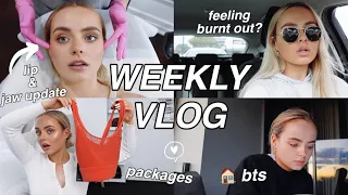 WEEKLY VLOG | LIP & JAW UPDATE | OPENING PACKAGES | FEELING BURNT OUT? | HOUSE BTS | Conagh Kathleen