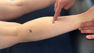 Trigger Point Therapy Technique - Flexor digitorum longus  #triggerpointtherapy