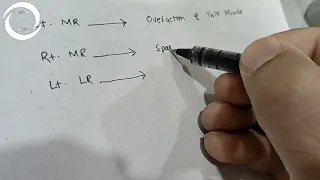 Sequelae of Horizontal Muscle Paralysis