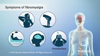 Fibromyalgia