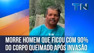 Morre homem que ficou com 90% do corpo queimado após ter casa invadida