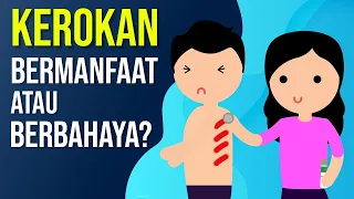 Manfaat dan Bahaya Kerokan